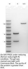 Anti-Human FOLR1(Farletuzumab)