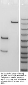 Anti-Human CD40(Lucatumumab)