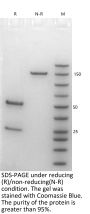 Anti-Human CD25(Camidanlumab)