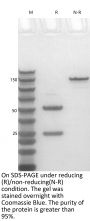 Anti-Human CCL2(Carlumab)