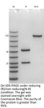 Anti-Human SLC34A2(Upifitamab)
