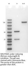 Anti-Human C5(Eculizumab)