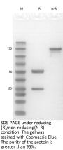Anti-Human GPNMB(Glembatumumab)
