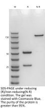 Anti-Human TNFA(Infliximab)
