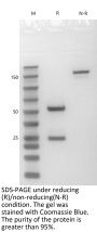 Anti-Human CD158A(Lirilumab)