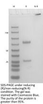 Anti-Human serotype IATS O11(Panobacumab)