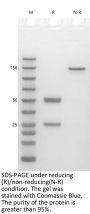 Anti-Human HGF(Rilotumumab)