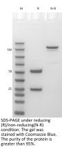 Anti-Human IGF1R(Robatumumab)