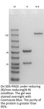 Anti-Human IL-7RA(Lusvertikimab)