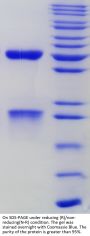 Anti-Human C1s [Sutimlimab Biosimilar]