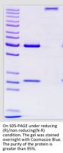 Anti-Human EGFR(Necitumumab)