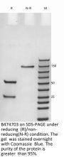 Anti-Human FcRn(Rozanolixizumab)