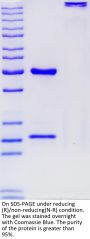 Anti-Human CTLA4(Ipilimumab)