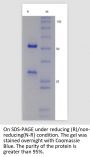 Tinurilimab (CEACAM6 Tab)