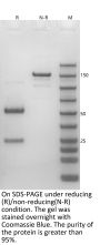 Aducanumab