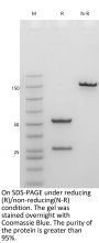 Anti-Human IGF1R(Teprotumumab)