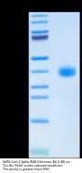 SARS-CoV-2 Spike RBD (Omicron BA.2.38) Protein (BA2-HM138)
