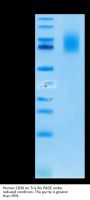 Human CD30/TNFRSF8 Protein (CD3-HM430)