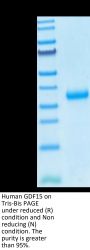 SARS-COV-2 Spike RBD (N501Y) Protein (COV-VM1BY)