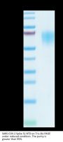 SARS-COV-2 Spike S1 NTD Protein (COV-VM1SN)