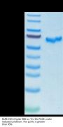 SARS-COV-2 Spike RBD Protein (COV-VM3BD)