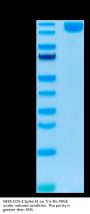 SARS-COV-2 Spike S1 Protein (COV-VM5S1)