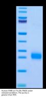 Human FSHB Protein (FSH-HM10B)