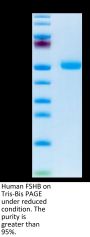 Human FSHB Protein (FSH-HM201)
