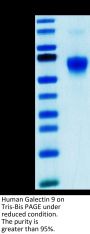 Human Galectin 9/LGALS9 Protein (GLT-HM109)
