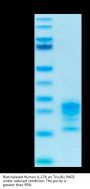 Biotinylated Human IL-17A/CTLA-8 Protein (ILA-HM418B)