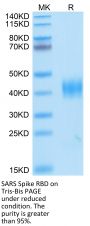SARS Spike RBD Protein (SAR-VM4BD)