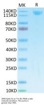 SARS Spike S1 Protein (SAR-VM5S1)