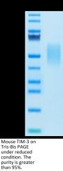 Mouse Tim-3/HAVCR2 Protein (TIM-MM131)