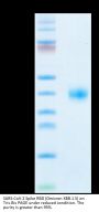 SARS-CoV-2 Spike RBD (Omicron XBB.1.5) Protein (XBB-HM115)